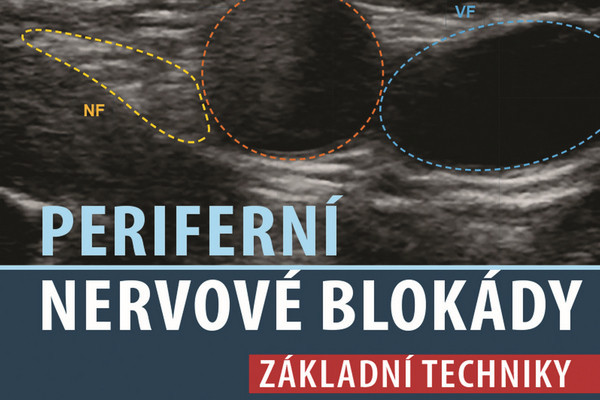 Periferní nervové blokády
