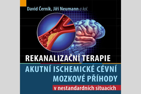 Rekanalizační terapie akutní ischemické cévní mozkové příhody v nestandardních situacích