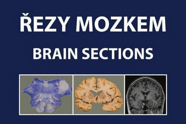 Řezy mozkem / Brain Sections